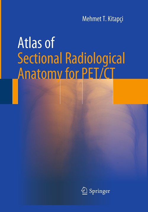 Atlas of Sectional Radiological Anatomy for PET/CT by Mehmet T Kitapci ISBN 9781493940912