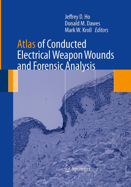 Atlas of Conducted Electrical Weapon Wounds and Forensic Analysis by Jeffrey D Ho ISBN 9781493941186