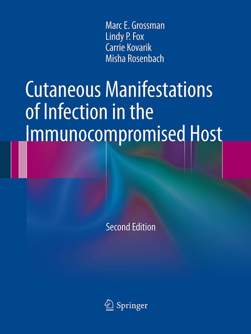 Cutaneous Manifestations of Infection in the Immunocompromised Host by Marc E Grossman ISBN 9781493951079