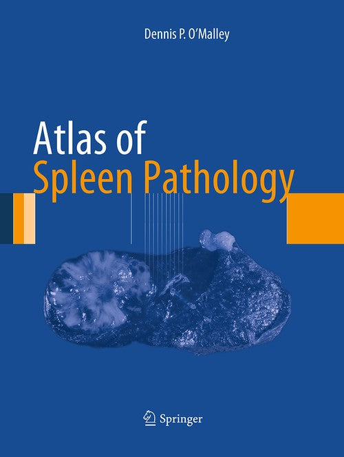 Atlas of Spleen Pathology by Dennis P O'malley ISBN 9781493952335