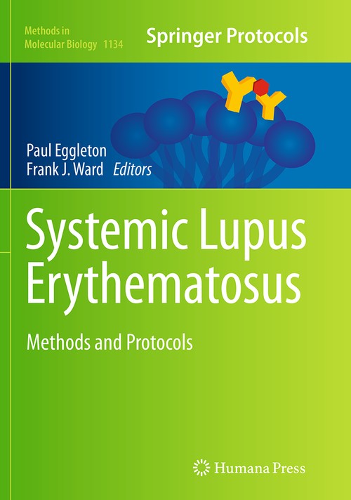 Systemic Lupus Erythematosus by Paul Eggleton ISBN 9781493952625