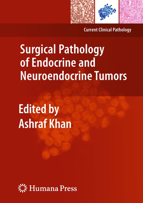 Surgical Pathology of Endocrine and Neuroendocrine Tumors by Ashraf Khan 9781493961153