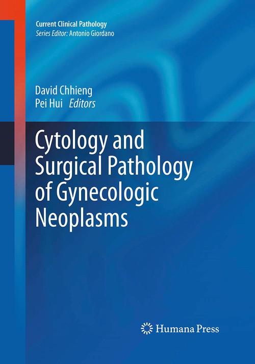 Cytology and Surgical Pathology of Gynecologic Neoplasms by David Chhieng 9781493961672