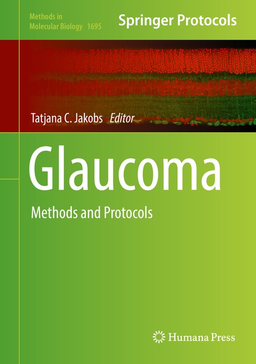 Glaucoma by Tatjana C Jakobs ISBN 9781493974061