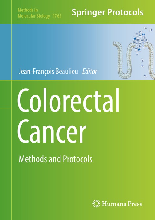 Colorectal Cancer by Jeanfranois Beaulieu ISBN 9781493977642
