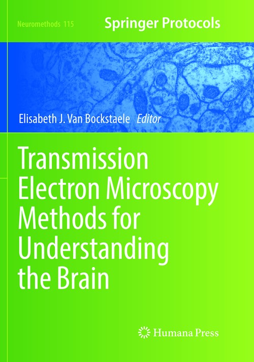Transmission Electron Microscopy Methods for Understanding the Brain by Elisabeth J Van Bockstaele ISBN 9781493981038