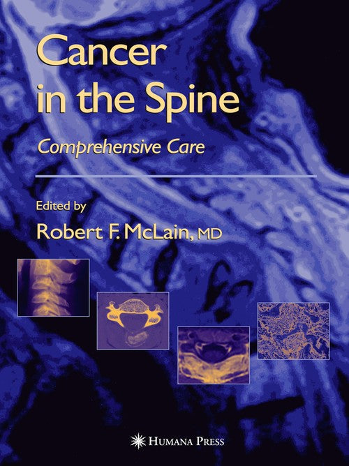Cancer in the Spine by Robert F Mclain ISBN 9781588290748