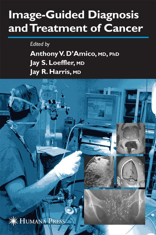Image-Guided Diagnosis and Treatment of Cancer by Jay Harris ISBN 9781588291141