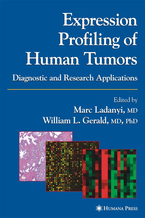 Expression Profiling of Human Tumors by Marc Ladanyi ISBN 9781588291226
