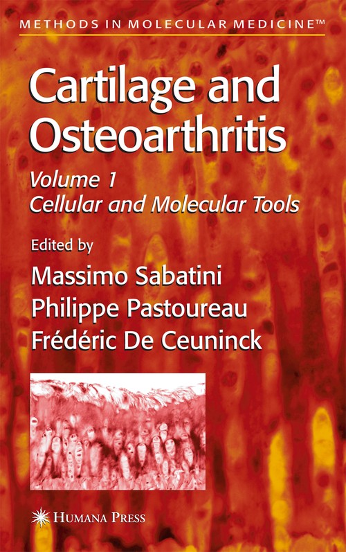 Cartilage and Osteoarthritis by Massimo Sabatini ISBN 9781588292476