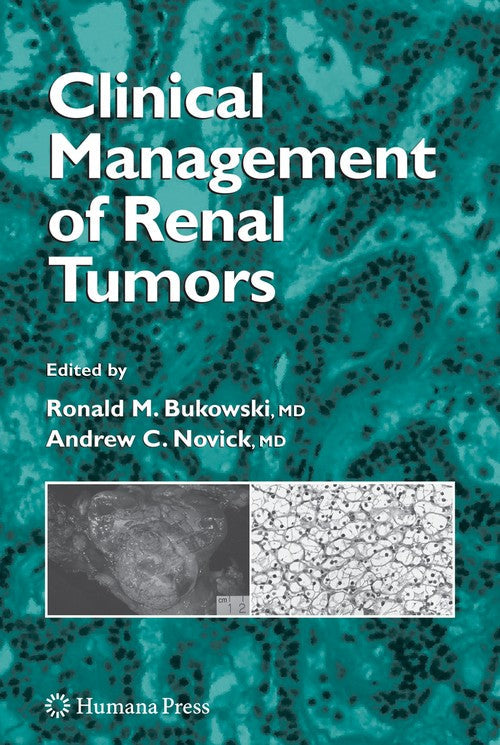 Clinical Management of Renal Tumors by Ronald M Bukowski ISBN 9781588292513