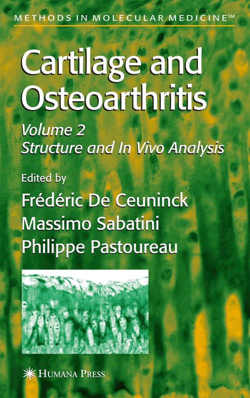 Cartilage and Osteoarthritis by Massimo Sabatini ISBN 9781588295057