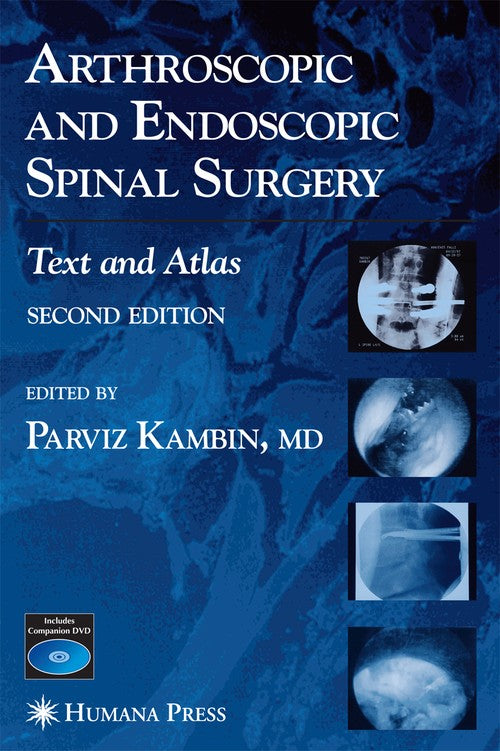 Arthroscopic and Endoscopic Spinal Surgery by Parviz Kambin