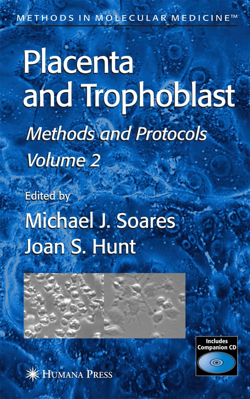 Placenta and Trophoblast by Michael J Soares ISBN 9781588296085