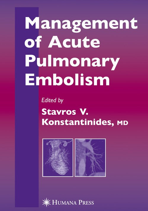 Management of Acute Pulmonary Embolism by Stavros V Konstantinides ISBN 9781588296443