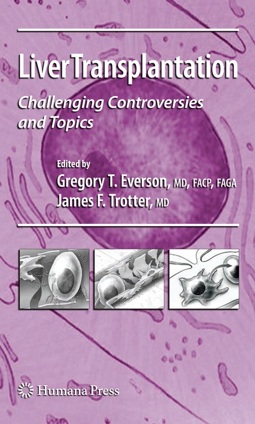 Liver Transplantation by Gregory T Everson ISBN 9781588297938