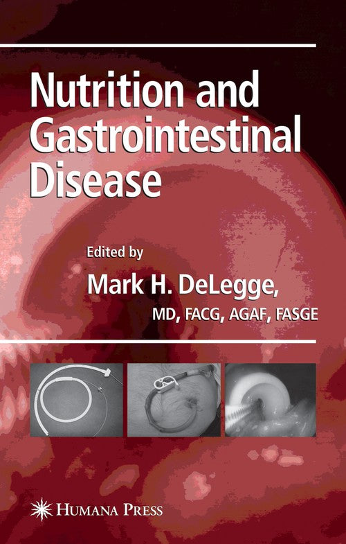 Nutrition and Gastrointestinal Disease by Mark Delegge 9781588298089