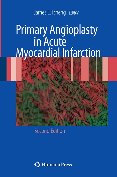 Primary Angioplasty in Acute Myocardial Infarction by James E Tcheng ISBN 9781603274968