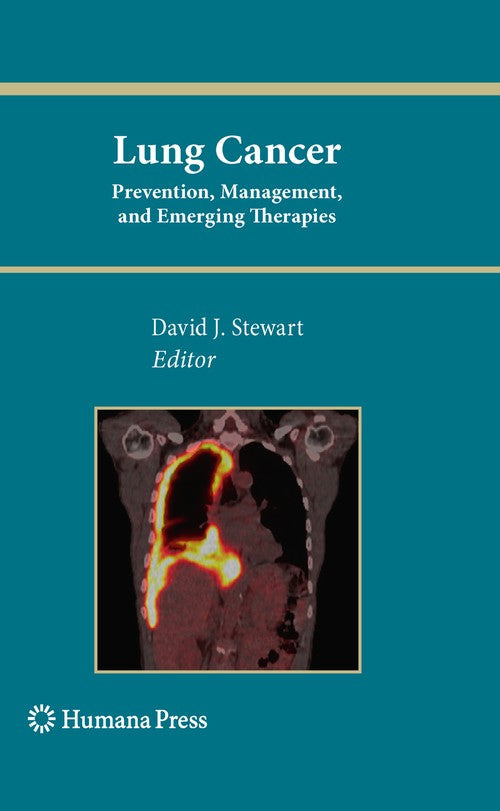 Lung Cancer: by David J Stewart ISBN 9781607615231