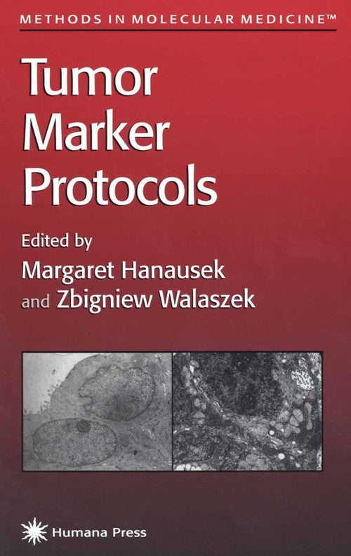 Tumor Marker Protocols by Margaret Hanausek 9781617370199