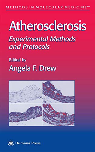 Atherosclerosis by Angela F Drew ISBN 9781617371684