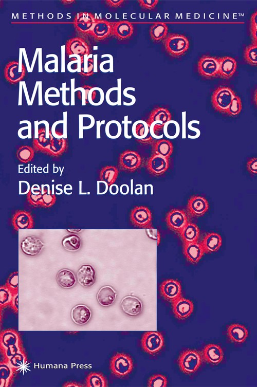 Malaria Methods and Protocols by Denise L Doolan 9781617372056