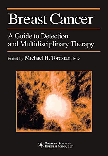 Breast Cancer by Michael H Torosian ISBN 9781617372162