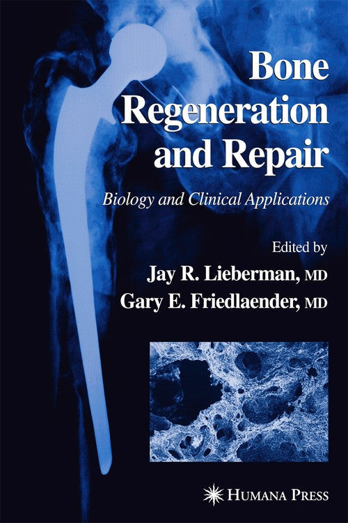 Bone Regeneration and Repair by Jay R Lieberman ISBN 9781617372193