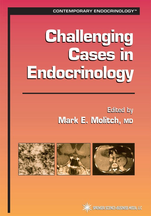 Challenging Cases in Endocrinology by Mark E Molitch ISBN 9781617372490