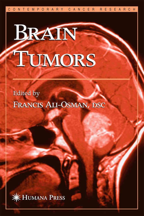 Brain Tumors by Francis Ali-Osman ISBN 9781617373206