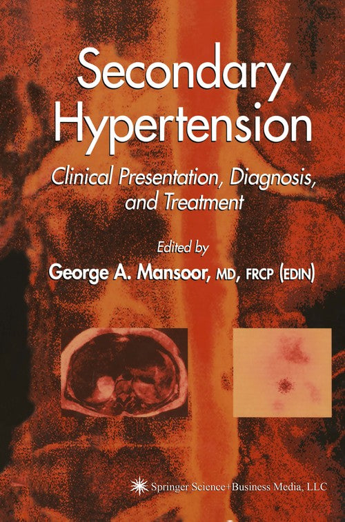 Secondary Hypertension by George A Mansoor ISBN 9781617373831