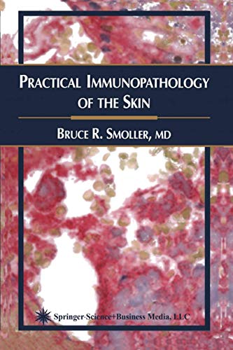 Practical Immunopathology of the Skin by Bruce R Smoller 9781617373893