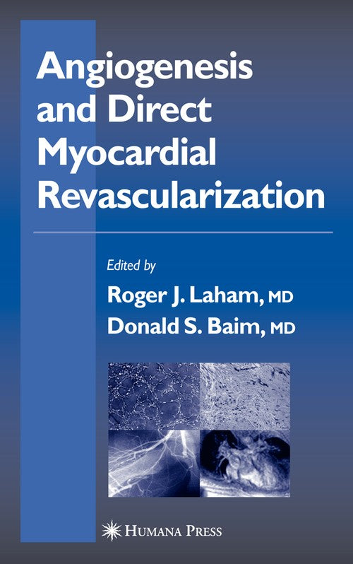 Angiogenesis and Direct Myocardial Revascularization by Roger J Laham ISBN 9781617373930
