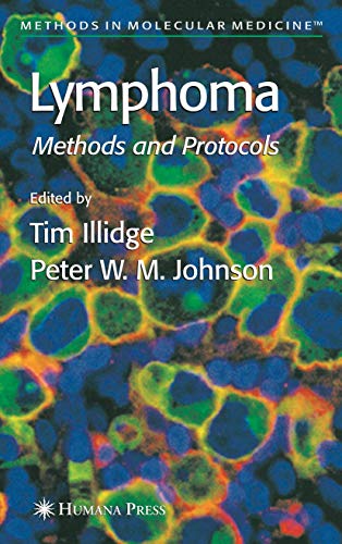 Lymphoma by Tim Illidge ISBN 9781617373954
