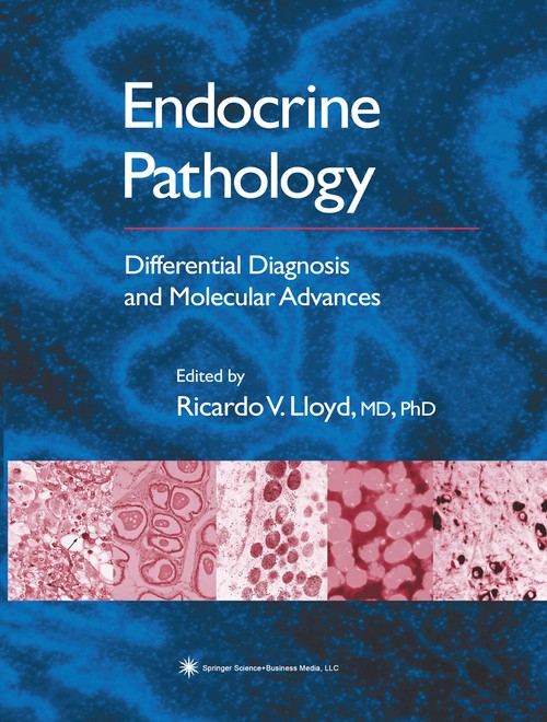 Endocrine Pathology by Ricardo V Lloyd 9781617374234