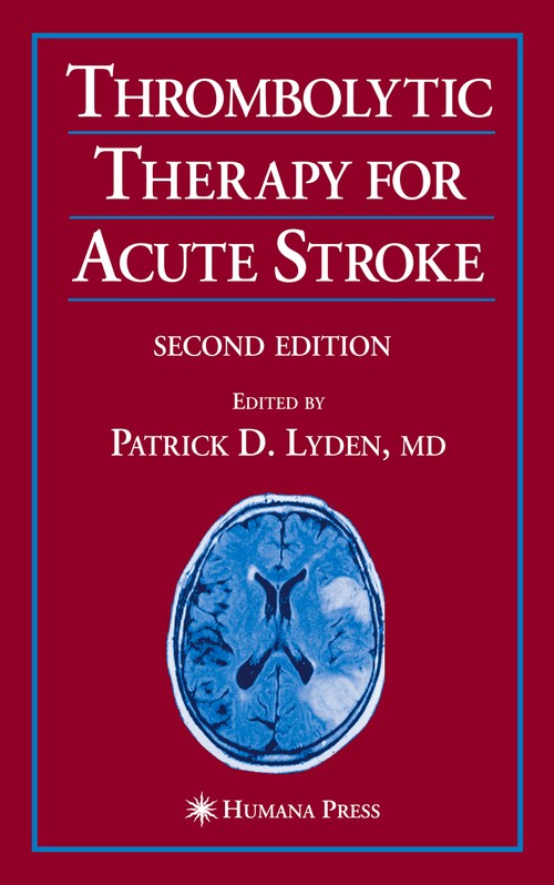 Thrombolytic Therapy for Acute Stroke by Patrick D Lyden ISBN 9781617375408