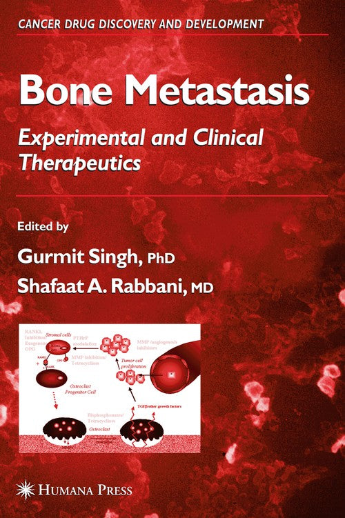 Bone Metastasis by Gurmit Singh ISBN 9781617375453