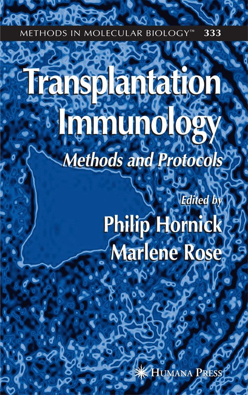 Transplantation Immunology by Philip Hornick ISBN 9781617376320