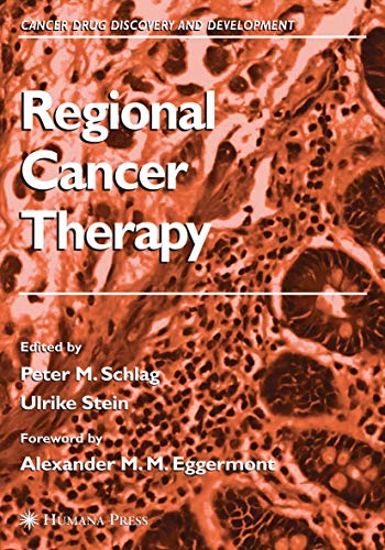 Regional Cancer Therapy by Peter M Schlag ISBN 9781617377112