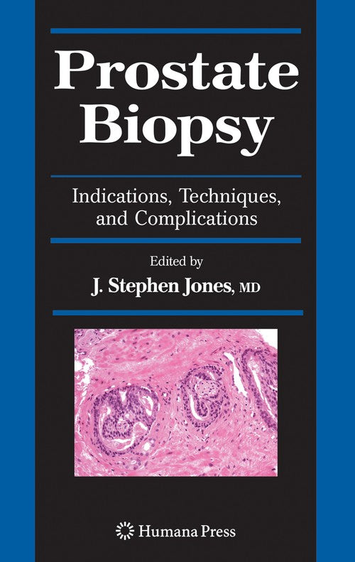 Prostate Biopsy by J Stephen Jones Md 9781617377808
