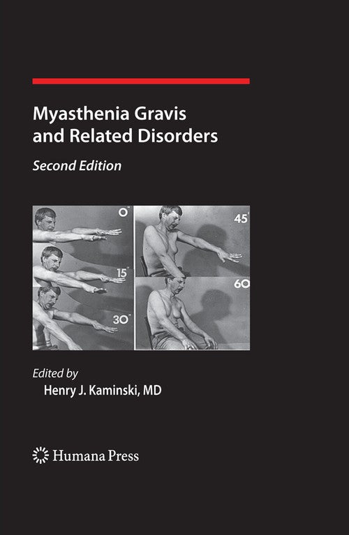 Myasthenia Gravis and Related Disorders by Henry J Kaminski ISBN 9781617378058