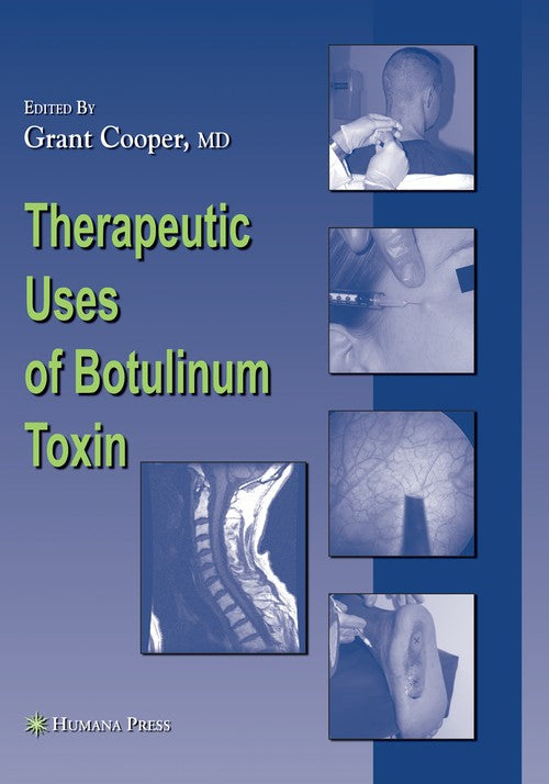 Therapeutic Uses of Botulinum Toxin by Grant Cooper 9781617378423
