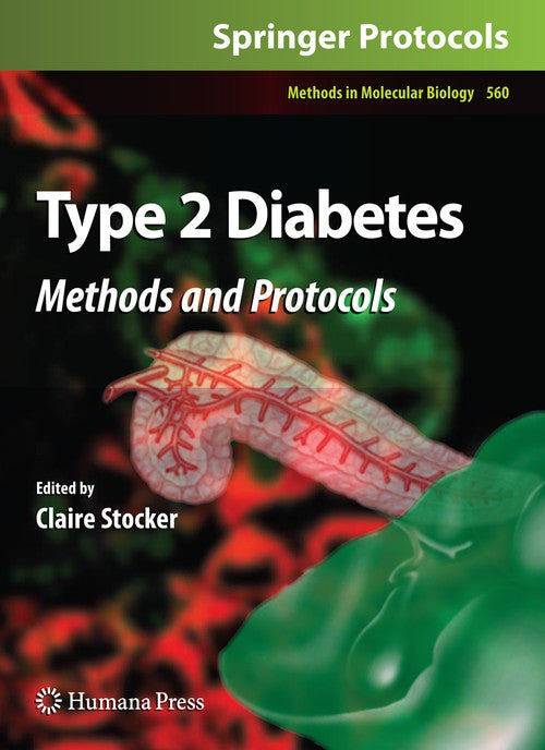 Type 2 Diabetes by Claire Stocker ISBN 9781617794926