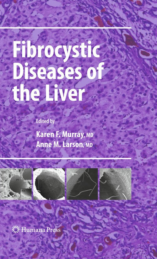 Fibrocystic Diseases of the Liver by Karen F Murray ISBN 9781617796852