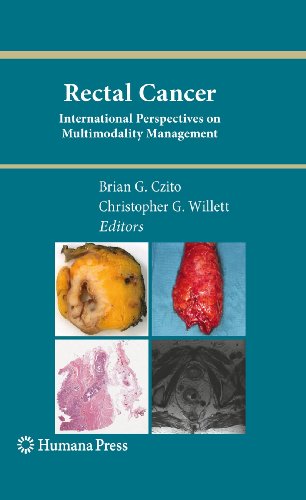 Rectal Cancer by Brian G Czito ISBN 9781617796951