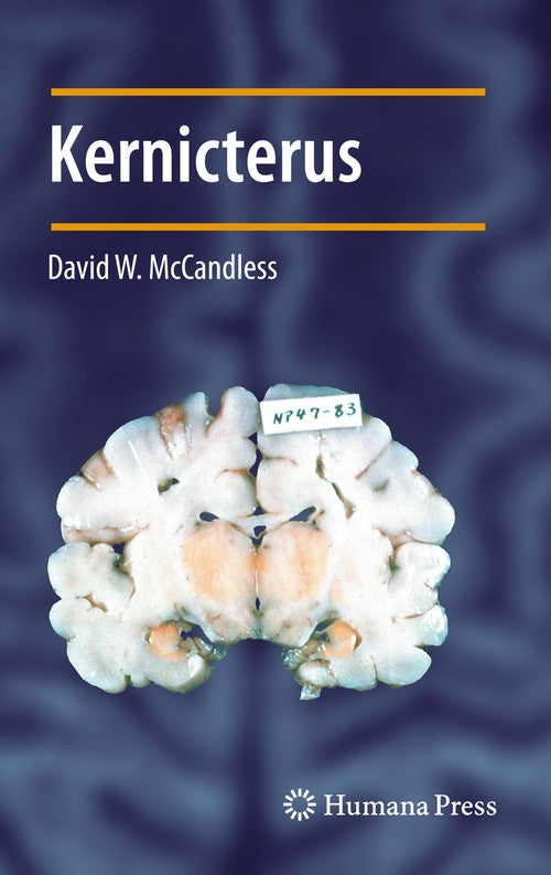 Kernicterus by David W Mccandless ISBN 9781617797019