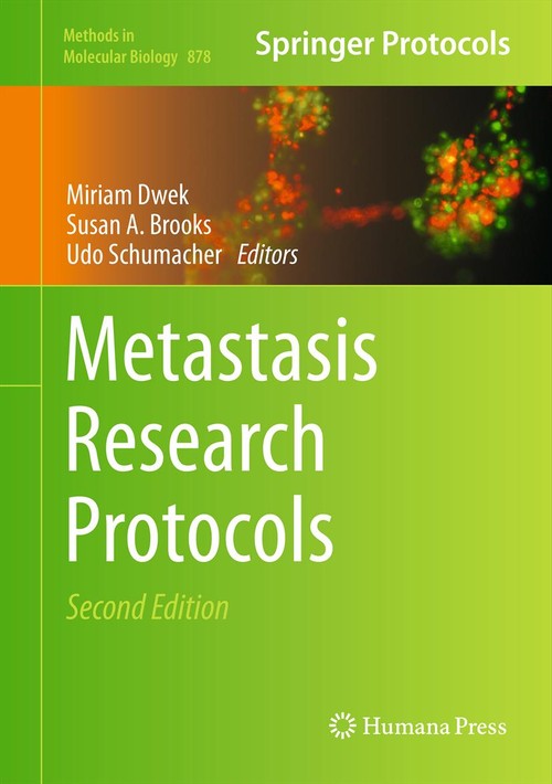 Metastasis Research Protocols by Miriam Dwek ISBN 9781617798535