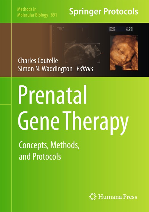 Prenatal Gene Therapy by Charles Coutelle ISBN 9781617798726