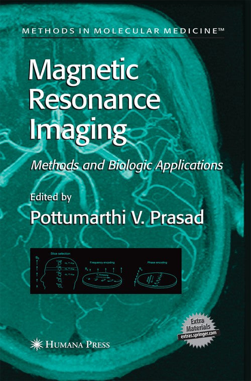 Magnetic Resonance Imaging by Pottumarthi V Prasad 9781627038126
