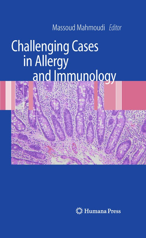 Challenging Cases in Allergy and Immunology by Massoud Mahmoudi 9781627038355